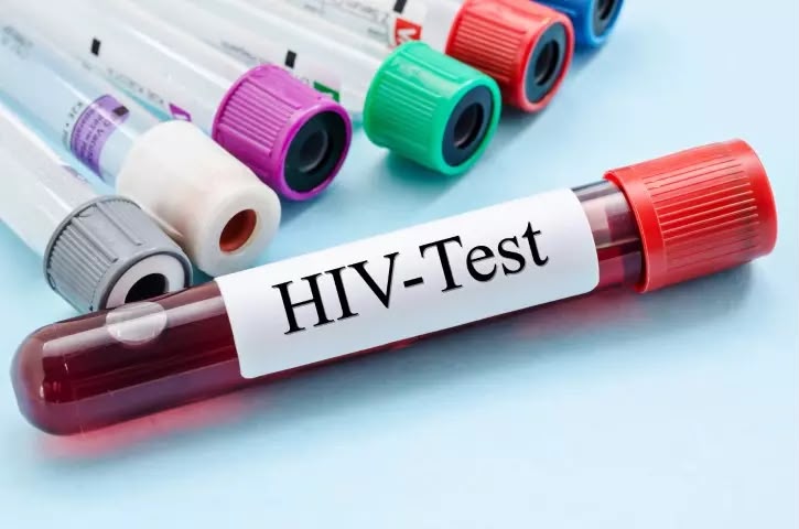 HIV status cannot be used to deny employment under Ghana law – Ghana AIDS Commission