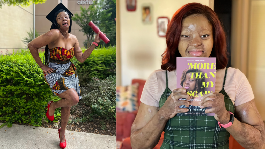 From surviving a plane crash to inspiring millions: How Kechi Okwuchi turned tragedy into triumph