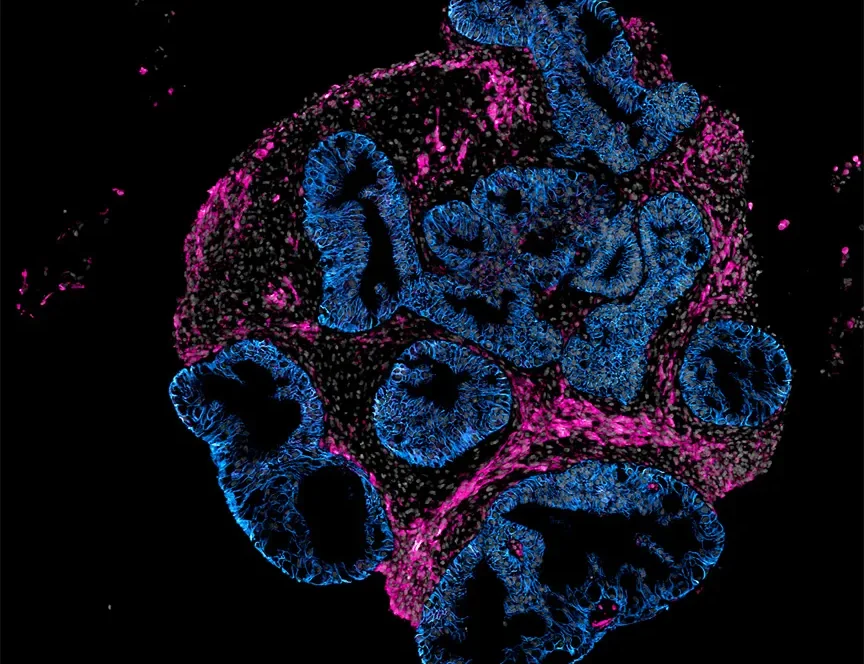 Intero Biosystems wants drugmakers to test on mini human intestines, not animals