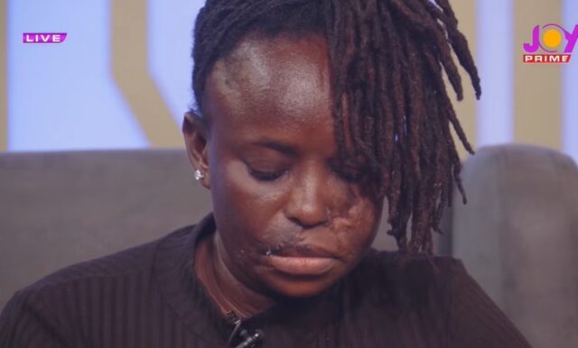 “It’s in God’s hands” – Accident survivor fears she may never find love