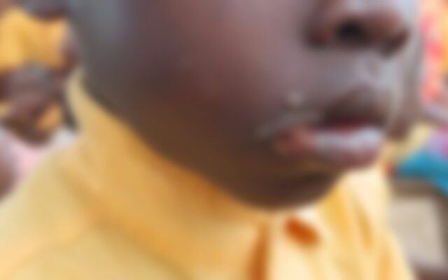 Mafi Kope residents appeal for urgent medical intervention over illnesses affecting children, adults