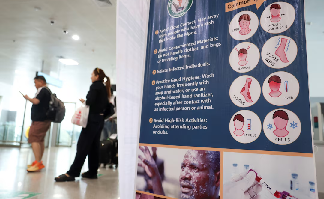 Airport temperature checks offer comfort but won’t catch Ebola – Prof Amuasi